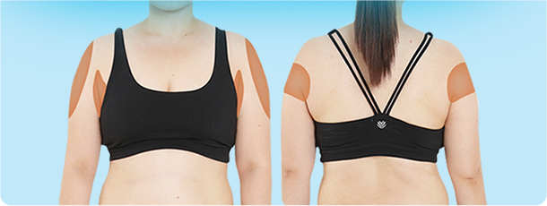 ภาพแสดงแขนที่หนาเรียวลงหลังทำ V-Logic Body PT