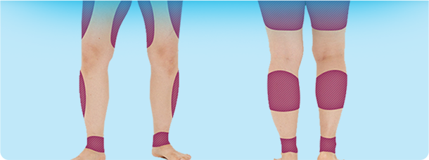 ภาพแสดงขาที่เคยหนาเรียวลงหลังทำ V-Logic Body PT