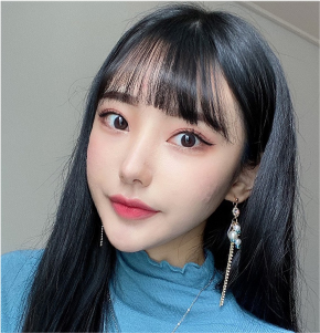 ผลลัพธ์การเปลี่ยนแปลงหลัง contour tox ลดแก้มทำให้กรอบหน้าชัดขึ้นและหน้าเล็กลง