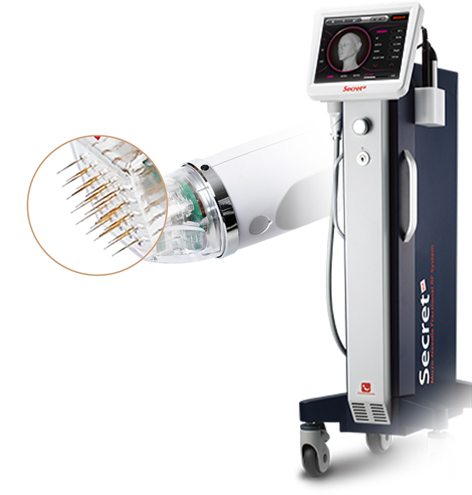 ภาพรายละเอียดของเครื่อง Secret Laser และเข็มเซลล์ฟื้นฟูขนาดเล็ก