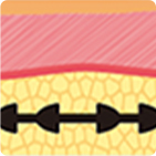 โครงสร้างไหมยกกระชับที่พัฒนาอย่างต่อเนื่องจากรุ่นที่ 1 ถึง 4